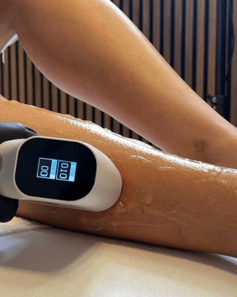 laserbehandeling rotterdam